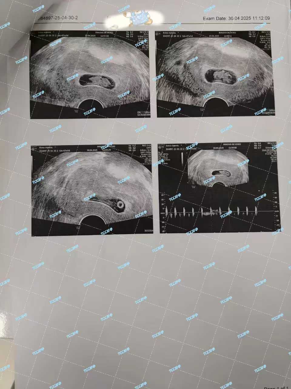 格鲁吉亚助孕 格鲁吉亚助孕